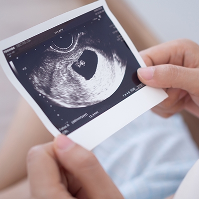 Baby ultrasound print